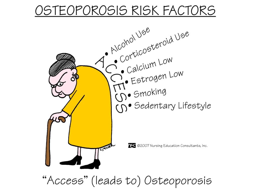 Osteoporose | Dr. Fernando Ferro | Cirurgia do Quadril em Goiânia